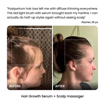 Oilogy 22-Ingredient Hair Growth Serum - Oilogy