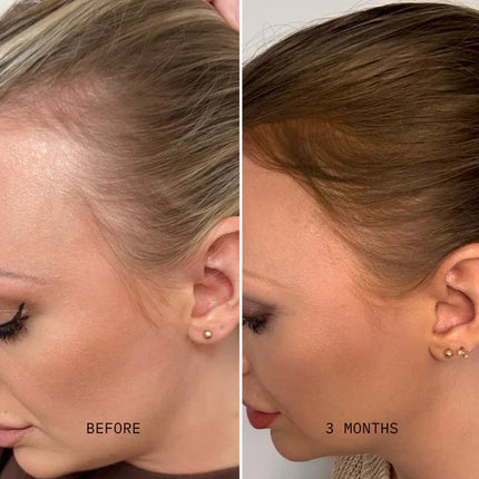 Oilogy Dermapulse™ Scalp Restoration Kit - Oilogy